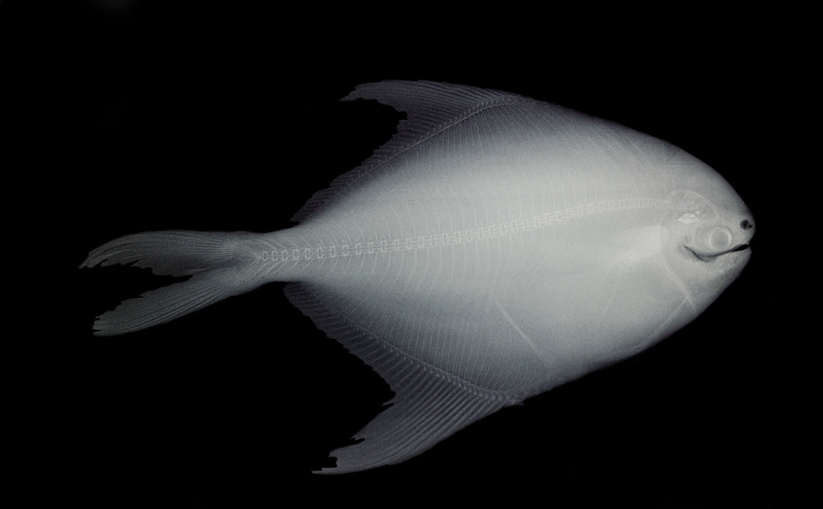 Fish X-ray